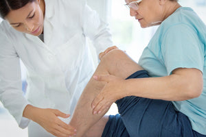 varicose veins